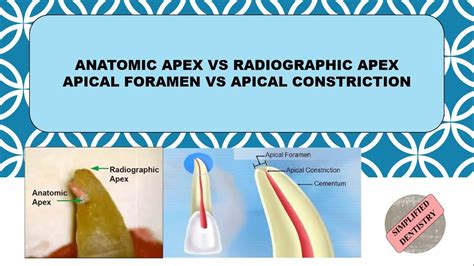 A radiographic comparison of apical root pdf