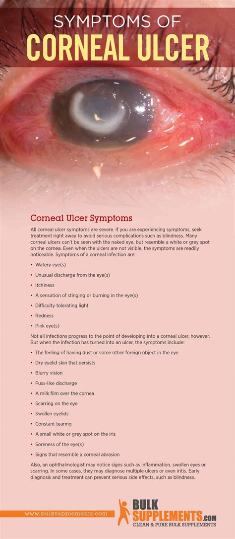 A simple guide to corneal ulcers diagnosis treatment and related. - Nursing assistant care the basics study guide.
