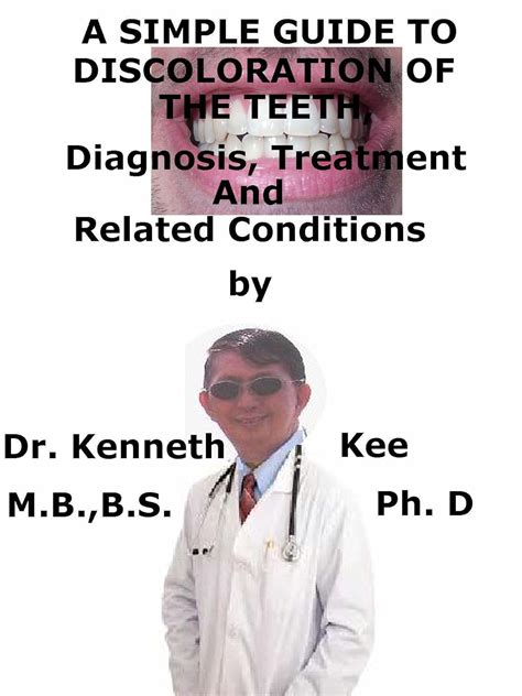 A simple guide to discoloration of the teeth diagnosis treatment and related conditions a simple guide. - Terres de la grande-anse, des aulnaies et du port-joly..