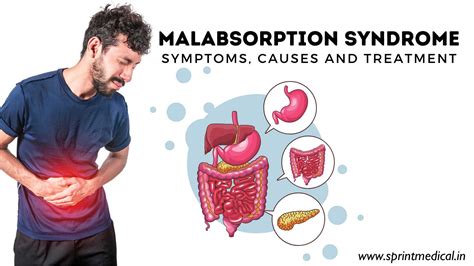 A simple guide to malabsorption syndrome treatment and related diseases. - Orla lehmann og den nationale kunst.