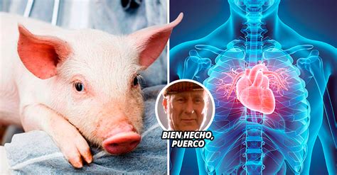 A un mes del trasplante, cómo sigue el hombre que recibió el corazón de un cerdo