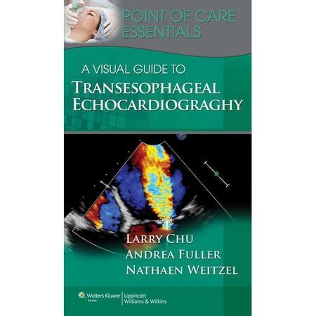 A visual guide to transesophageal echocardiography by larry f chu. - Bad girl gone good ghetto tales book 1.