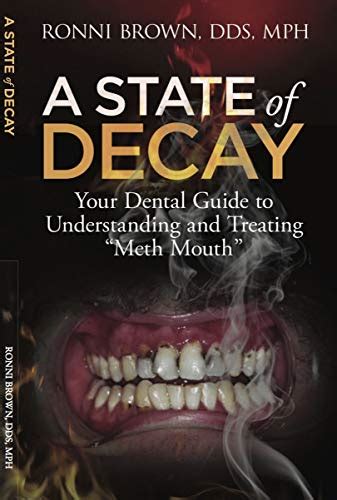 Read Online A State Of Decay Your Dental Guide To Understanding And Treating Meth Mouth By Dds