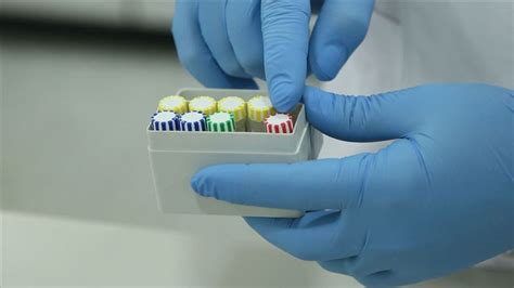 ABD’de 5 dakikada sonuç veren 'koronavirüs test kiti' geliştirildi. 
