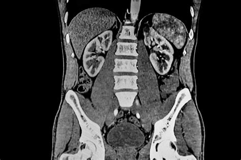 Abdominal and Pelvic CT - coolestguyplanet.net