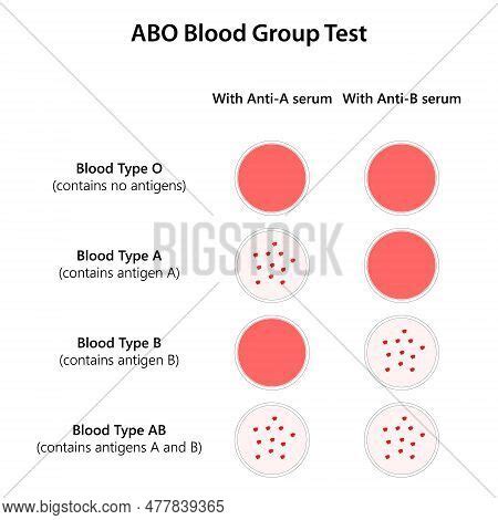 ABO Blood Group Test. Scientific Technology. Stock Vector