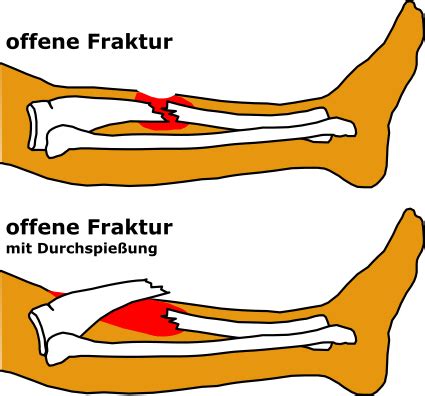 About: Fraktur - DBpedia Association - muktibox.com