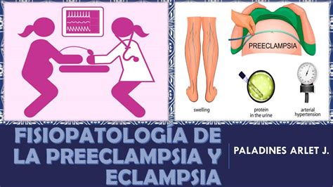 ACV preeclampsia y eclampsia pdf