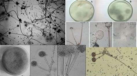 Agar plate growth studies of Rhizopus oligosporus and Aspergillus ... - muktibox.com
