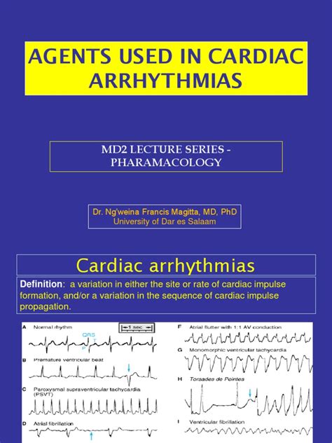 AGENTS USED IN CARDIAC ARRYTHMIAS ppt