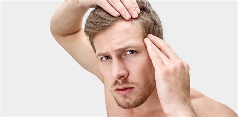 AL Aesthetics Chester on Instagram: "Hair thinning is common in …