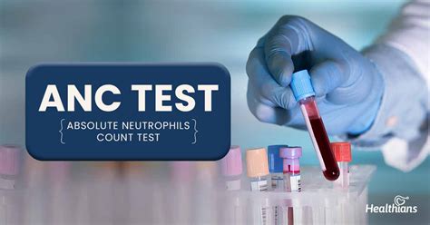 ANC-201 Online Test