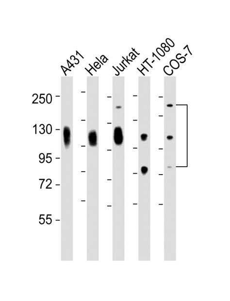 APP Antibody - WB, IHC-P, E - Buy Now! Abcepta