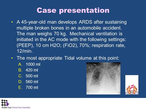 ARDS Case Presentation