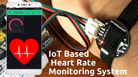 ARDUINO BASED ABNORMAL HEART RATE DETECTION AND WIRELESS COMMUNICATION