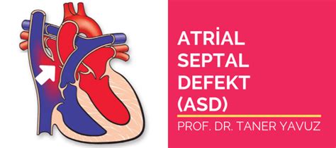 ASD Atrial septal defekt.
