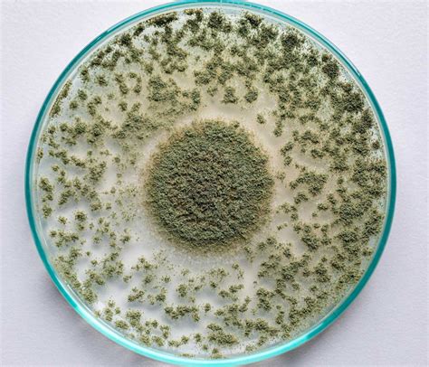 Aspergillus oryzae - Oxford Academic - muktibox.com