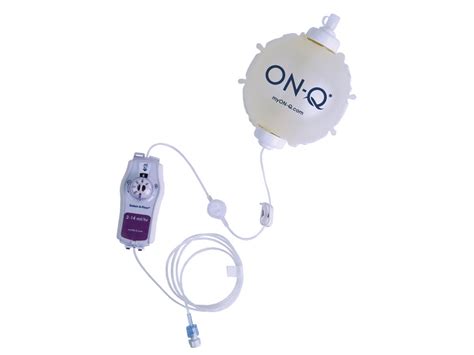 AVANOS #kapadokya vlog-2 #nevşehir 4000 yıllık. 