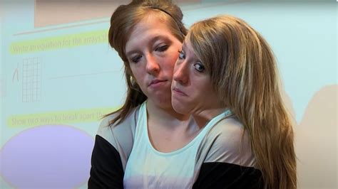 Abby and brittany hensel. Feb 21, 2023 - Abigail and Brittany Hensel are conjoined twins, born with separate heads but a completely joined body - an extremely rare condition that is ... 