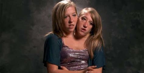 Abby and Brittany Hensel, the conjoined 