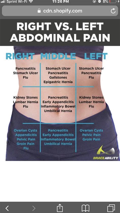 Abdomen Pain Chart Female