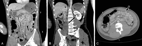 Abdominal/pelvic trauma Radiology Key