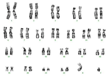 Aberatii cromozomiale poze