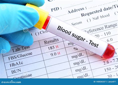 Abnormal Blood Sugar Diagnosis And Treatment - IDEPEM …