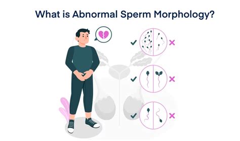 Abnormal Sperm Morphology: Causes, Treatments & Prevention