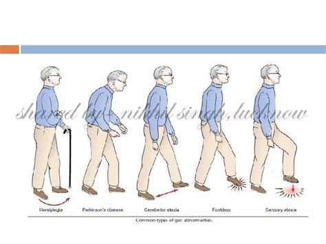 Abnormal gait