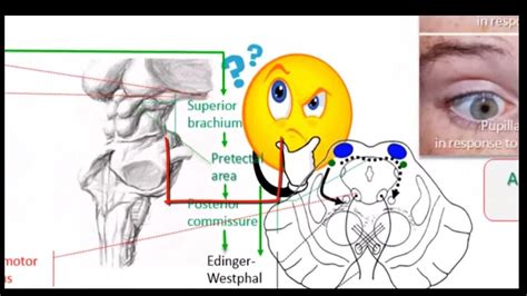 Abnormal pupillary reflexes - YouTube