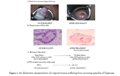 Abnormal vaginas. .  ...