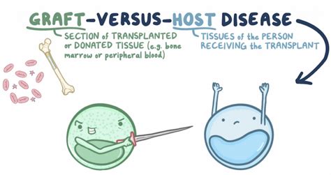 About graft versus host disease GvHD