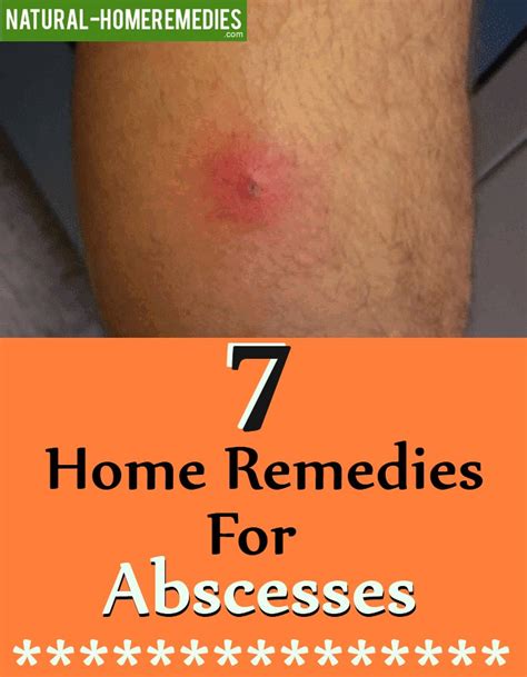 Abscess Treatment in Homeopathy Guide to Homeopathy Remedies for Abscess