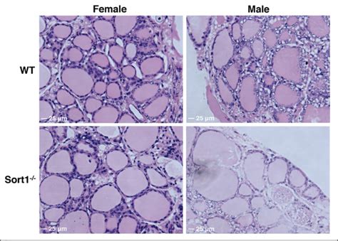 Absence of A Thyroid Phenotype in Sortilin-Deficient Mice