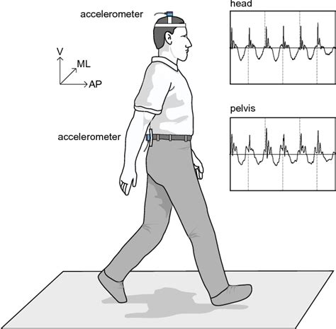 Acceleration Patterns Head and Pelvis 2