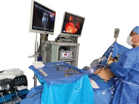 Acessa procedure nyc.  The benefits of radiofrequency ablation include: 1.  Known as th...