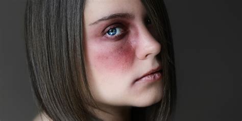 Acial abuse. Things To Know About Acial abuse. 