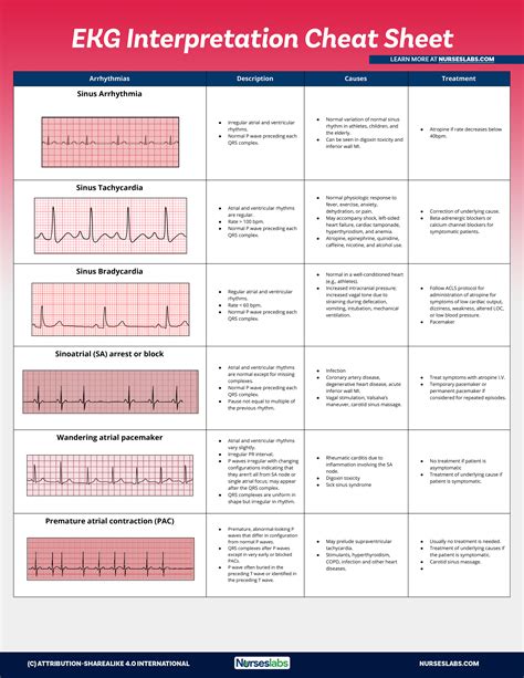 Use this EKG interpretation cheat sheet such summarizes all heart
