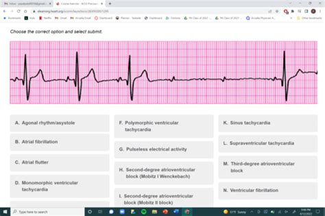 Acls precourse assessment quizlet. Amiodarone 150 mg IV bolus; start infusion. 2. A repeat dose of epinephrine 1 mg IV. 3. Lidocaine 1 to 1.5 mg IV; star infusion. 4. 1 to 2 L of normal saline. 5. Amiodarone 300 mg IV. Study with Quizlet and memorize flashcards containing terms like 3˚ AV block p and qrs completely separate, Pulseless electrical activity (PEA), Coarse ... 