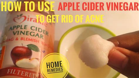 Raw apple cider vinegar contains: Acetic acid, which can kill harmful bacteria. ACV is about 5% to 6% acetic acid. Natural probiotics (good bacteria), which can improve your immune system and gut .... 