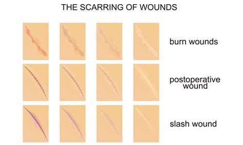 Acquired an Injury That Created a Scar Final Draft
