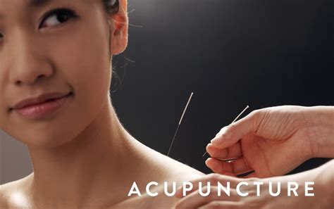 Acupuncture Essentials
