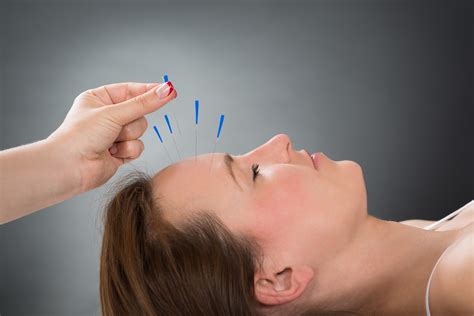 Acupuncture in the Treatment Of