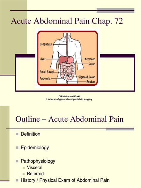 Acute Abdominal Pain by Dr Iraqi