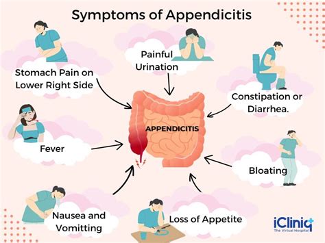Acute Appendicitis Clinical Manifestation and Diagnosis