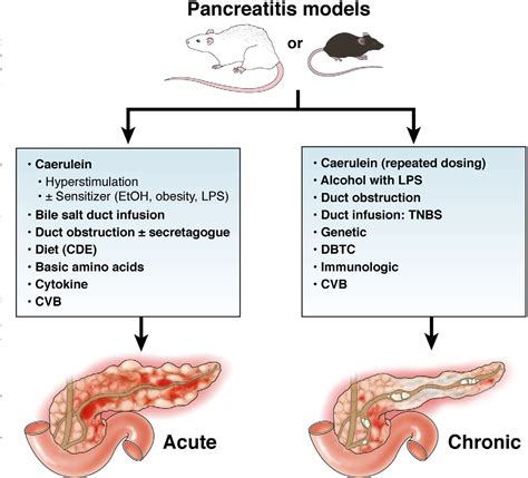 Acute Chronic Pancreatitis