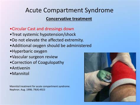 Acute Compartmetn Syndrome Update on Diagnosis and Treatment