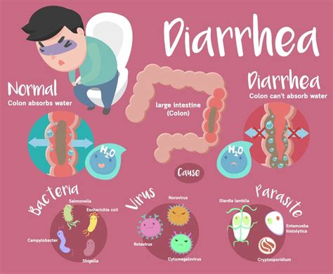 Acute Diarrhea 1
