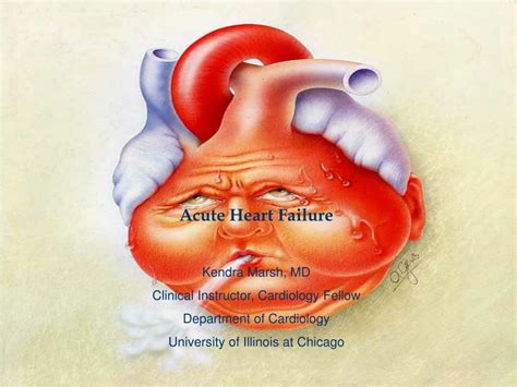 Acute Heart Dailure